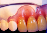 Valplast